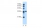 PTCH1 antibody - C-terminal region